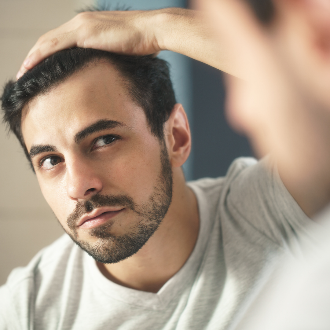 Hair Fall, Hair Loss, And Hair Density - HairMNL