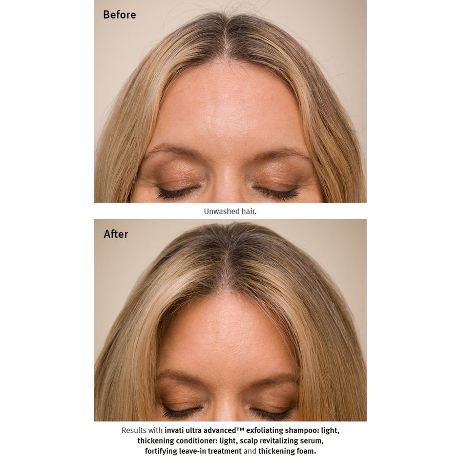 AVEDA Invati Ultra Advanced Exfoliating Shampoo Light Before and After - HairMNL