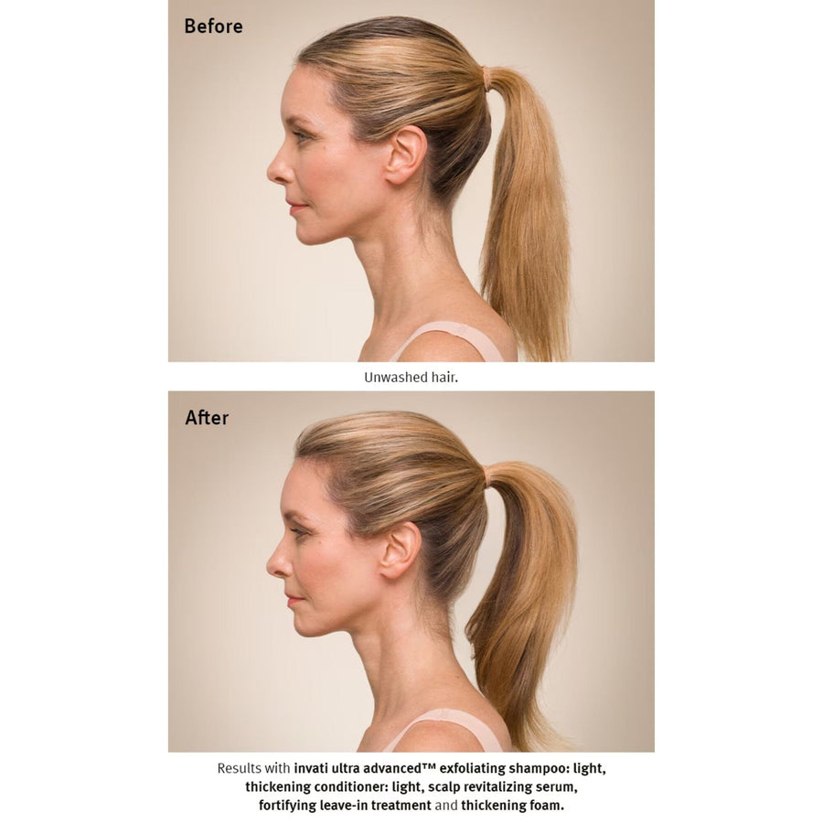 AVEDA Invati Ultra Advanced Exfoliating Shampoo Light Before and After Women Receding Hairline - HairMNL