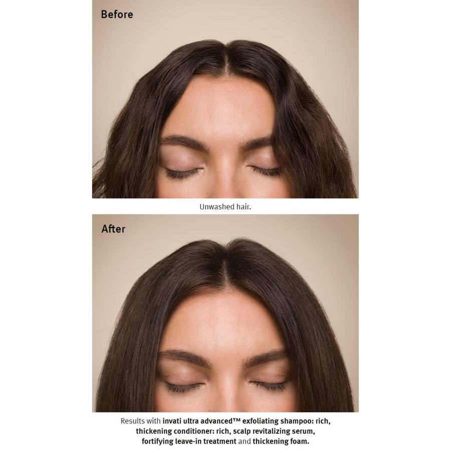 AVEDA Invati Ultra Advanced Before and After - HairMNL